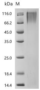 Pig Scavenger receptor cysteine-rich type 1 protein M130 (CD163), partial Recombinant Protein, C-10His, Sus scrofa (Pig), Sus scrofa (Pig), C-terminal 10xHis-tagged, 52.4 kDa, purity >≥ 95% as determined by SDS-PAGE.