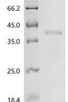 Human Transcription factor PU.1 (SPI1) Recombinant Protein - BioCrest Sci