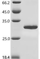 Bombyx mori Fibrohexamerin (P25) Recombinant Protein, C-His, aa 17–220, E.coli - BioCrest Sci