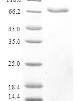 Human Ribonucleoside-diphosphate reductase subunit M2 B (RRM2B) Recombinant Protein - BioCrest Sci