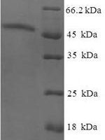 Human AKT-interacting protein (AKTIP) Recombinant Protein - BioCrest Sci