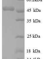 Human ATP synthase peripheral stalk subunit OSCP, mitochondrial (ATP5PO) Recombinant Protein - BioCrest Sci