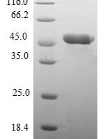 Human Myosin regulatory light chain 2, atrial isoform (MYL7) Recombinant Protein - BioCrest Sci