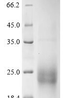 Human Cytotoxic T-lymphocyte protein 4 (CTLA4), partial Recombinant Protein, N-Twin-Strep/C-His-Avi - BioCrest Sci