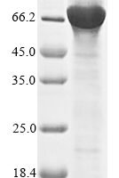 Human Nuclear receptor ROR-gamma (RORC) Recombinant Protein - BioCrest Sci