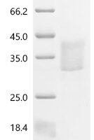 Rat Hypoxia-inducible factor 1-alpha（Hif1a), partial Recombinant Protein, C-10His - BioCrest Sci