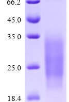 Human Single Ig IL-1-related receptor (SIGIRR), partial Recombinant Protein - BioCrest Sci