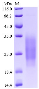Human Single Ig IL-1-related receptor (SIGIRR), partial Recombinant Protein, Homo sapiens (Human), Mammalian cell, C-terminal 6xHis-tagged, 14.8 kDa, purity >≥ 95% as determined by SDS-PAGE.