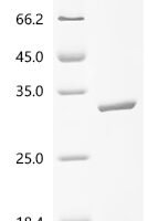 Escherichia coli O6:H1 Uncharacterized protein yciO (yciO) Recombinant Protein - BioCrest Sci
