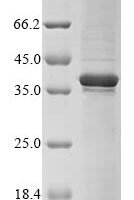 Human Four and a half LIM domains protein 1 (FHL1) Recombinant Protein - BioCrest Sci