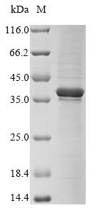 Human Four and a half LIM domains protein 1 (FHL1) Recombinant Protein, Homo sapiens (Human), E.coli, N-terminal 6xHis-tagged, 40.3 kDa, purity >≥ 85% as determined by SDS-PAGE.