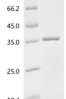 Human Myelin transcription factor 1 (MYT1), partial Recombinant Protein, C-10His - BioCrest Sci
