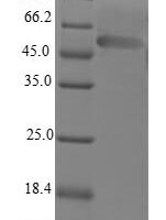 Human LIM domain-binding protein 3 (LDB3) Recombinant Protein - BioCrest Sci
