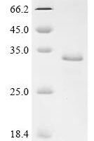 Mycobacterium tuberculosis Protein grpE (grpE) Recombinant Protein, C-His - BioCrest Sci