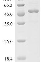 Human Dual specificity protein phosphatase 6 (DUSP6) Recombinant Protein - BioCrest Sci