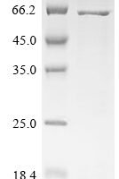 Canine parvovirus type 2 Capsid protein VP2, partial Recombinant Protein - BioCrest Sci