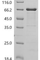 Mouse Tripartite motif-containing protein 72 (Trim72) Recombinant Protein, N-His-SUMO - BioCrest Sci