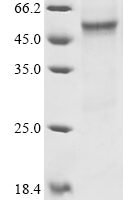 Human Carboxypeptidase N catalytic chain (CPN1) Recombinant Protein, C-His - BioCrest Sci