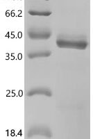 Human Interleukin-12 subunit beta (IL12B) Recombinant Protein, C-Twin-Strep - BioCrest Sci