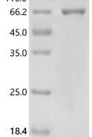 Human Glutamate receptor ionotropic, NMDA 1 (GRIN1), partial Recombinant Protein - BioCrest Sci