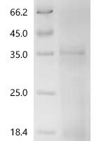 Human Programmed cell death 1 ligand 1 (CD274) (K136A), partial Recombinant Protein - BioCrest Sci