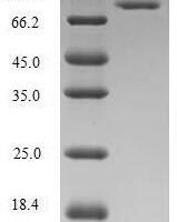 Human Methylenetetrahydrofolate reductase (NADPH) (MTHFR) Recombinant Protein, N-His-SUMO - BioCrest Sci