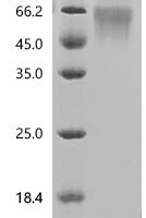 Human Eukaryotic translation initiation factor 4E-binding protein 1 (EIF4EBP1) Recombinant Protein, N-mFc - BioCrest Sci