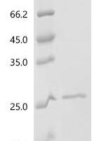 Bordetella pertussis Pertactin autotransporter (prn), partial Recombinant Protein, C-His, aa 348–486 - BioCrest Sci