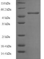 Mouse Ornithine transcarbamylase, mitochondrial (Otc) Recombinant Protein, N-His-SUMO - BioCrest Sci