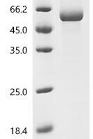 Human RNA-binding protein Nova-1 (NOVA1) Recombinant Protein, C-His, aa 1–507, Baculovirus - BioCrest Sci