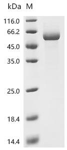 Human RNA-binding protein Nova-1 (NOVA1) Recombinant Protein, C-His, aa 1–507, Baculovirus, Homo sapiens (Human), Baculovirus, C-terminal 6xHis-tagged, 54.5 kDa, purity >≥ 85% as determined by SDS-PAGE.