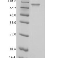 Escherichia coli Phosphoenolpyruvate carboxylase (ppc), partial Recombinant Protein - BioCrest Sci