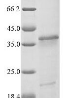 Vaccinia virus 14 kDa fusion protein (A27L) Recombinant Protein, N-His-SUMOstar - BioCrest Sci