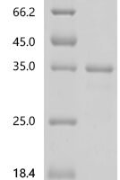 Rotavirus A Outer capsid glycoprotein VP7 Recombinant Protein, N-10His/C-Myc, aa 51–326, UniProt B3SRX9 - BioCrest Sci