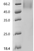 Human MHC Class I chain-related protein (MICA), partial Recombinant Protein, C-10His, aa 24–309, UniProt A0A385JFK0 - BioCrest Sci