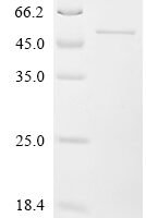 Arabidopsis thaliana Transcription factor VIP1 (VIP1) Recombinant Protein - BioCrest Sci