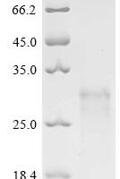 Human Eukaryotic translation initiation factor 4E (EIF4E) Recombinant Protein, N-His - BioCrest Sci