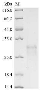Human Eukaryotic translation initiation factor 4E (EIF4E) Recombinant Protein, N-His, Homo sapiens (Human), Yeast, N-terminal 6xHis-tagged, 26.5 kDa, purity >≥ 95% as determined by SDS-PAGE.≥ 95% as determined by SEC-HPLC.