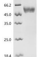 Human Neutral amino acid transporter 9 (SLC38A9), partial Recombinant Protein - BioCrest Sci