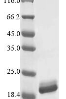 Mycobacterium smegmatis Porin MspA (mspA) Recombinant Protein - BioCrest Sci