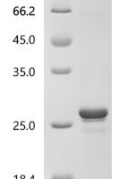 Human Ubiquitin carboxyl-terminal hydrolase 7 (USP7), partial Recombinant Protein - BioCrest Sci