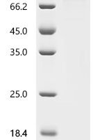 Human Cadherin-16 (CDH16), partial Recombinant Protein - BioCrest Sci