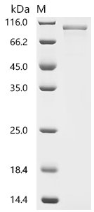 Human Cadherin-16 (CDH16), partial Recombinant Protein, Homo sapiens (Human), Baculovirus, C-terminal 10xHis-tagged, 84.7 kDa, purity >≥ 90% as determined by SDS-PAGE.