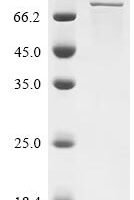 Human Protein-arginine deiminase type-2 (PADI2) Recombinant Protein, C-10His - BioCrest Sci