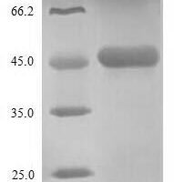 Zaire ebolavirus Nucleoprotein (NP), partial Recombinant Protein - BioCrest Sci