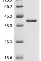 Human Integrin alpha-IIb (ITGA2B), partial Recombinant Protein, N-His, aa 639–887, E.coli - BioCrest Sci