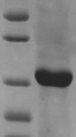 Chicken Riboflavin-binding protein, partial Recombinant Protein, N-His, aa 18–225, E.coli - BioCrest Sci