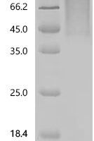 Human Interleukin-10 receptor subunit alpha (IL10RA)(R117C), partial Recombinant Protein - BioCrest Sci