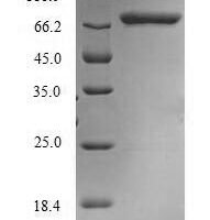 Human Methylenetetrahydrofolate reductase (NADPH) (MTHFR) Recombinant Protein, N-His - BioCrest Sci