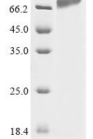 Human Integrin beta-7 (ITGB7), partial Recombinant Protein, N-10His - BioCrest Sci